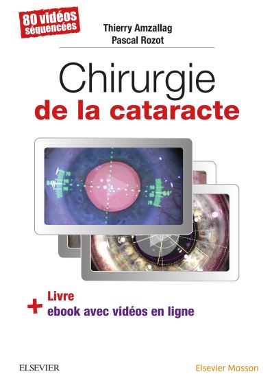 Livre + Ebook – Chirurgie de la cataracte